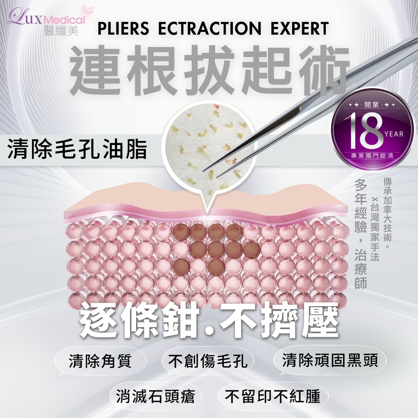 全港獨家【無痛鉗清】